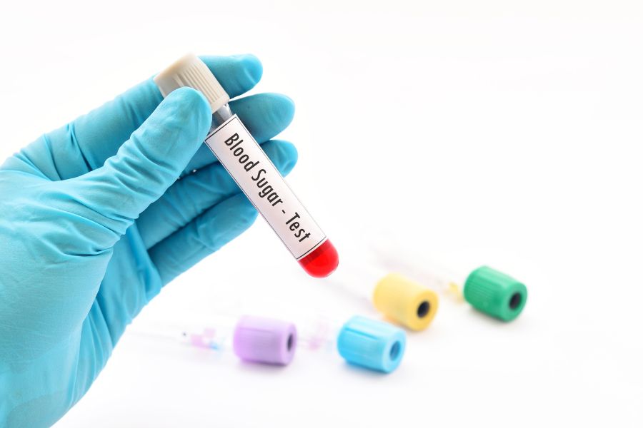 Causes of Symptoms of hyperglycemia Difference Between Symptoms of Hyperglycemia and Hypoglycemia 5