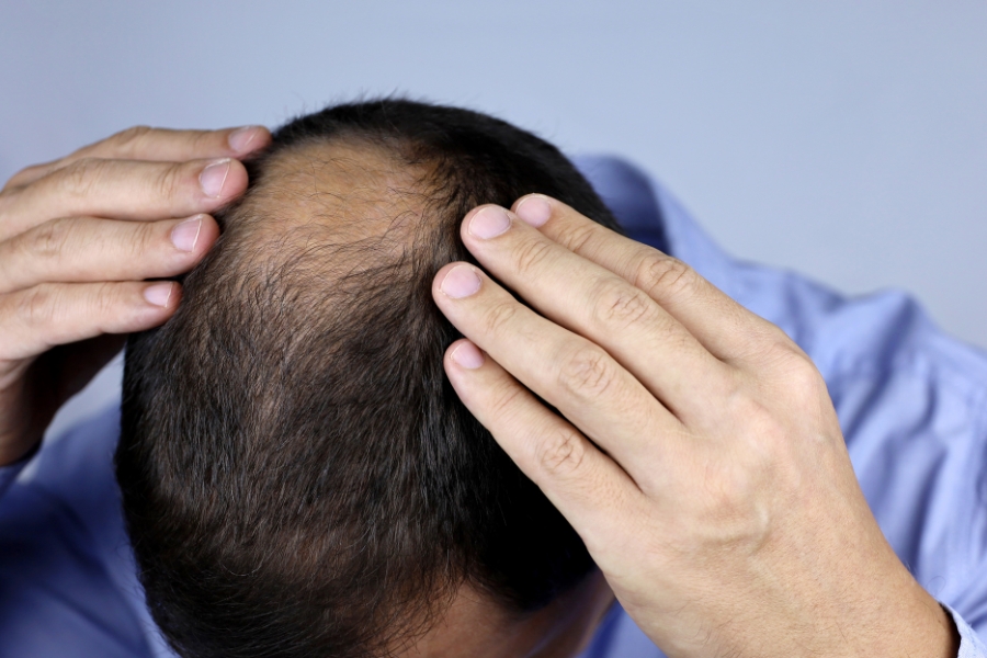What is Testosterone? The best effects of Testosterone on the male body What is Testosterone The best effects of Testosterone on the 8
